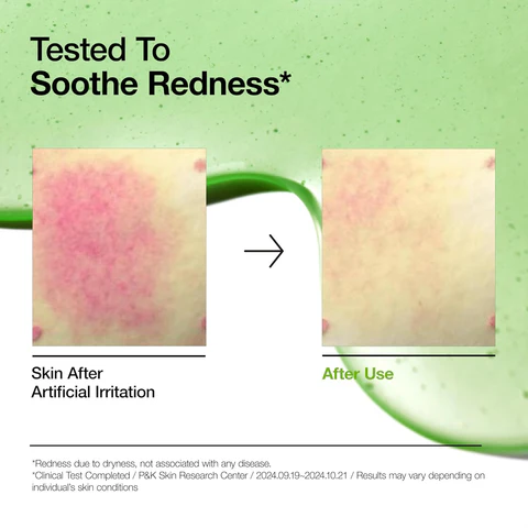 Anua - Azelaic Acid 10 Hyaluron Redness Soothing Serum - Image 4