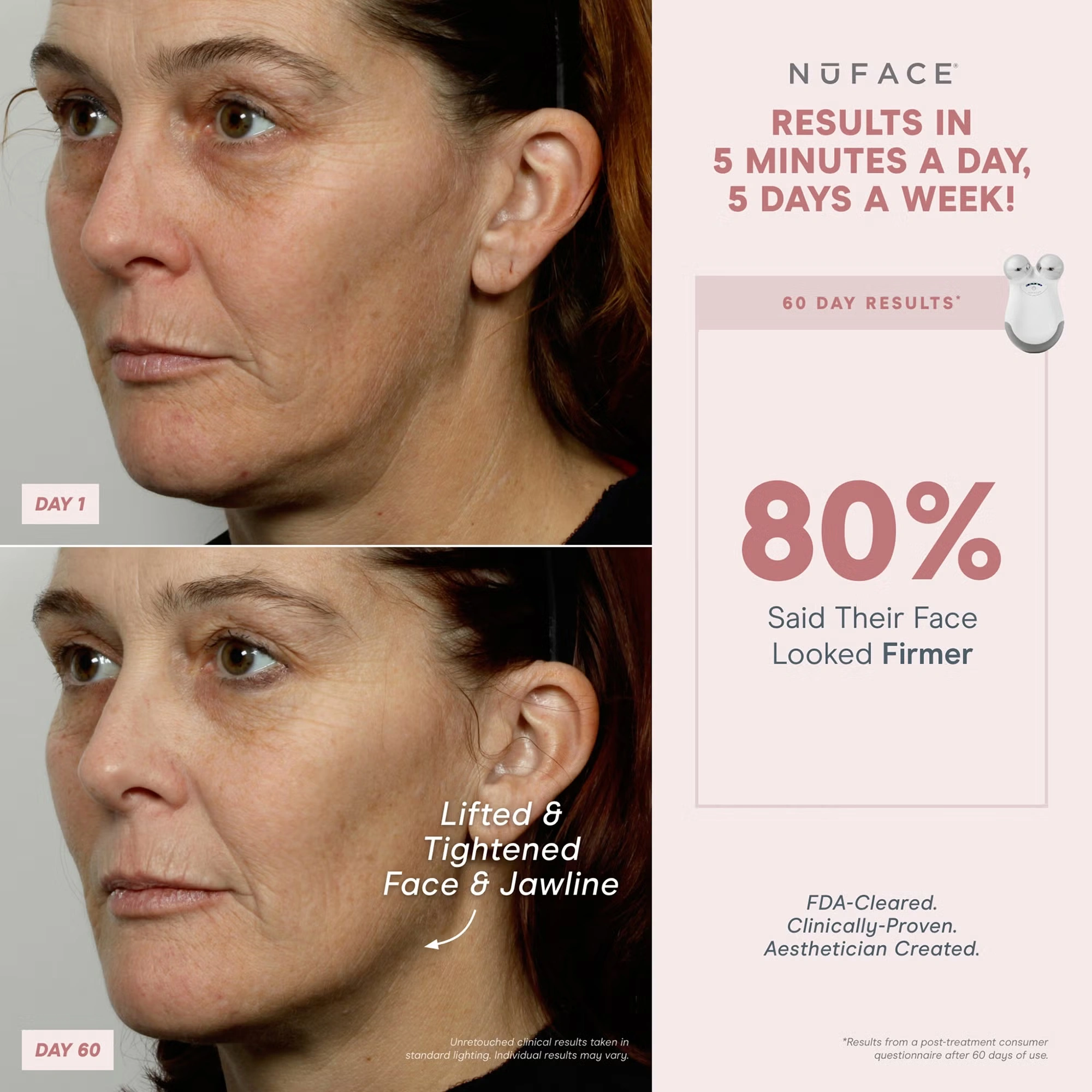 NuFACE® Mini Starter Kit - Image 5